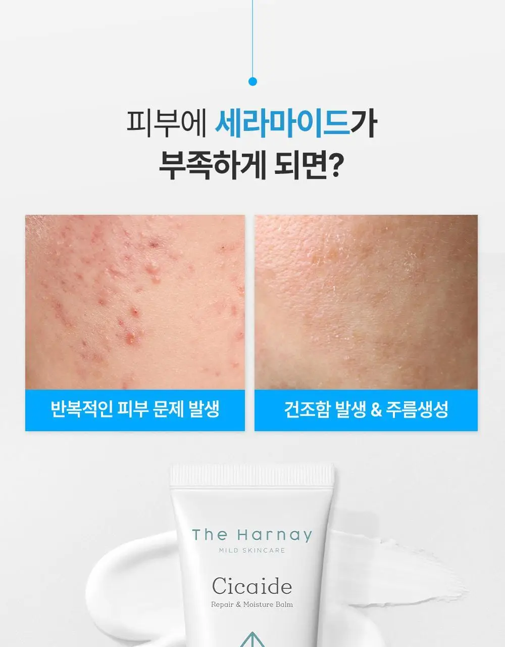 [피부장벽강화크림] 더하르나이 시카이드 밤 100ml기획(+앰플5ml*3p+크림5ml*2p) 상세페이지 16